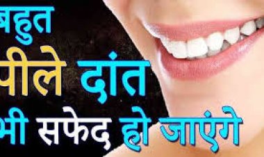 दांतो की सफाई का मतलब केवल ब्रश करना ही नही है, दांतो की सफाई के लिए अपनाए यह महत्वपूर्ण टिप्स