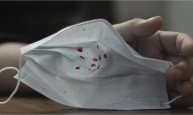 Mystery virus: तेजी से फैल रहा ये वायरस, लोगों को रही है खून की खांसी, एंटीबायोटिक्स भी असरदार नहीं हो रहे